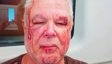 Petista de 69 anos é espancado em frente de casa no Rio por motivação política