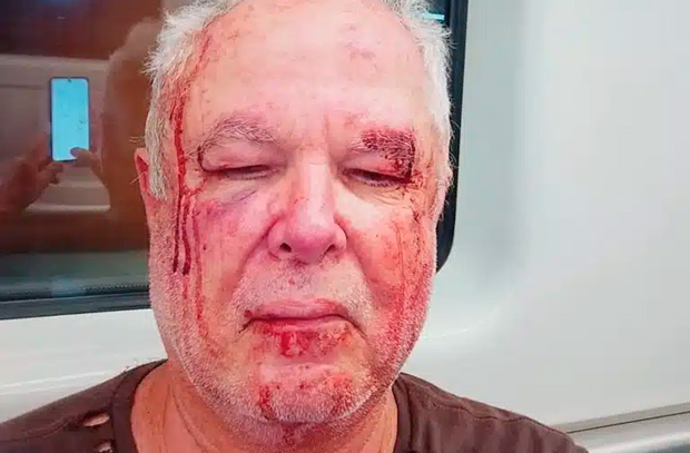 Petista de 69 anos é espancado em frente de casa no Rio por motivação política