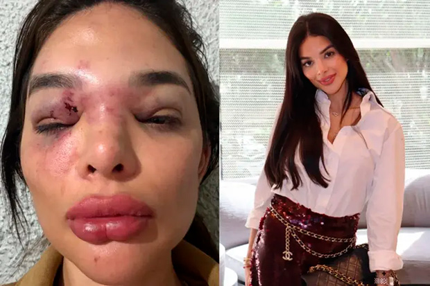 Empresário da Faria Lima é preso após denúncia de violência contra esposa