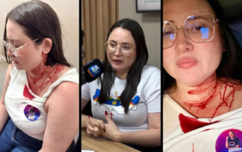 Candidata do PSOL é atacada com pedrada na cabeça em PE