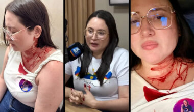 Candidata do PSOL é atacada com pedrada na cabeça em PE
