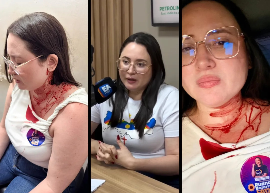 Candidata do PSOL é atacada com pedrada na cabeça em PE