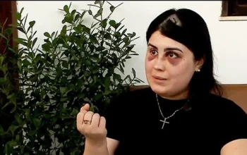 “Estou deformada”, diz mulher agredida por capitão da PM