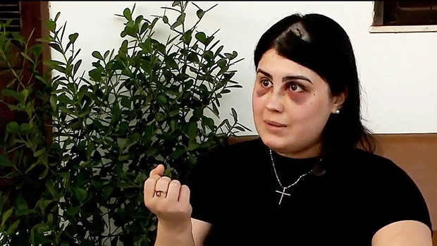 “Estou deformada”, diz mulher agredida por capitão da PM